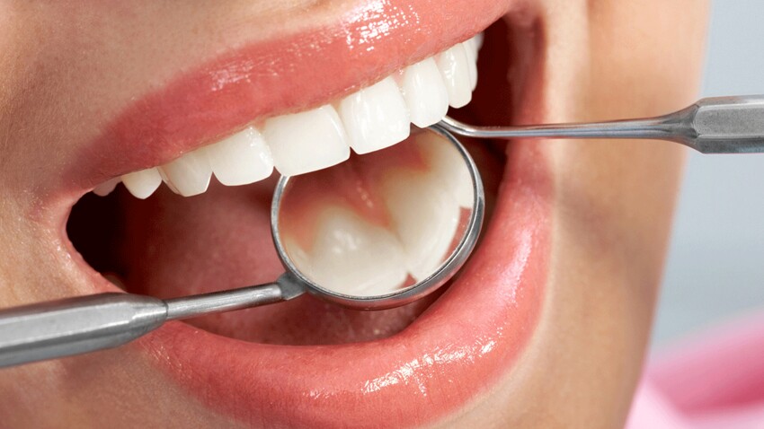 La prophylaxie est principalement tous les moyens nécessaires afin d'éviter l'apparition d'une maladie. Elle évite l'apparition de caries ainsi que le déchaussement des dents dans le but de garantir une excellente santé buccale. Prophylaxie dentaire